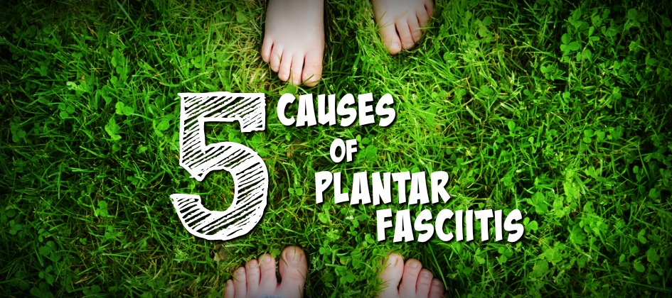 5 causes of plantar fasciitis
